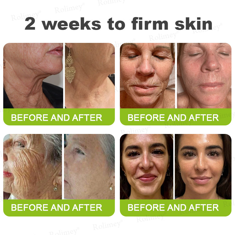 👨‍⚕️🧡Made and shipped from the USA 💫Rolimey® Botox & Vita-A Retinol Shot Wrinkle-Lift Tightening cream - Last Day Promotion 70% OFF