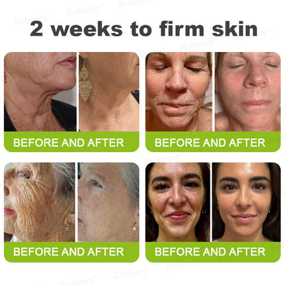 👨‍⚕️🧡Made and shipped from the USA 💫Rolimey® Botox & Vita-A Retinol Shot Wrinkle-Lift Tightening cream - Last Day Promotion 70% OFF