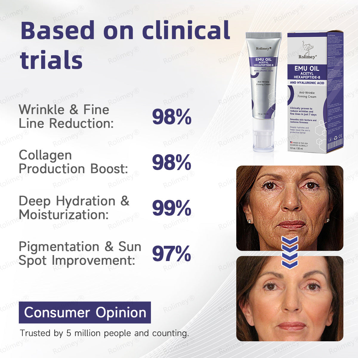 ✨✨Made in the USA: Rolimey® Emu Oil Anti-Wrinkle Firming Cream (Dermatologist Recommended)