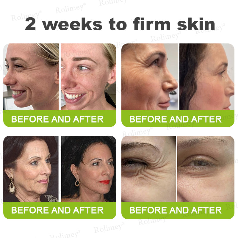 👨‍⚕️🧡Made and shipped from the USA 💫Rolimey® Botox & Vita-A Retinol Shot Wrinkle-Lift Tightening cream - Last Day Promotion 70% OFF