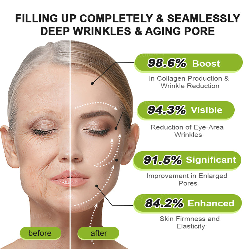 👨‍⚕️🧡Made and shipped from the USA 💫Rolimey® Botox & Vita-A Retinol Shot Wrinkle-Lift Tightening cream - Last Day Promotion 70% OFF