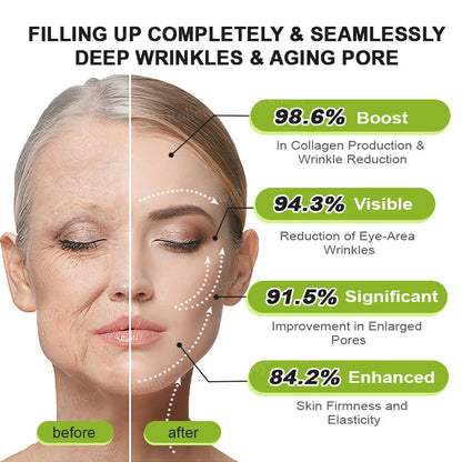 👨‍⚕️🧡Made and shipped from the USA 💫Rolimey® Botox & Vita-A Retinol Shot Wrinkle-Lift Tightening cream - Last Day Promotion 70% OFF