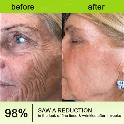 👨‍⚕️🧡Made and shipped from the USA 💫Rolimey® Botox & Vita-A Retinol Shot Wrinkle-Lift Tightening cream - Last Day Promotion 70% OFF