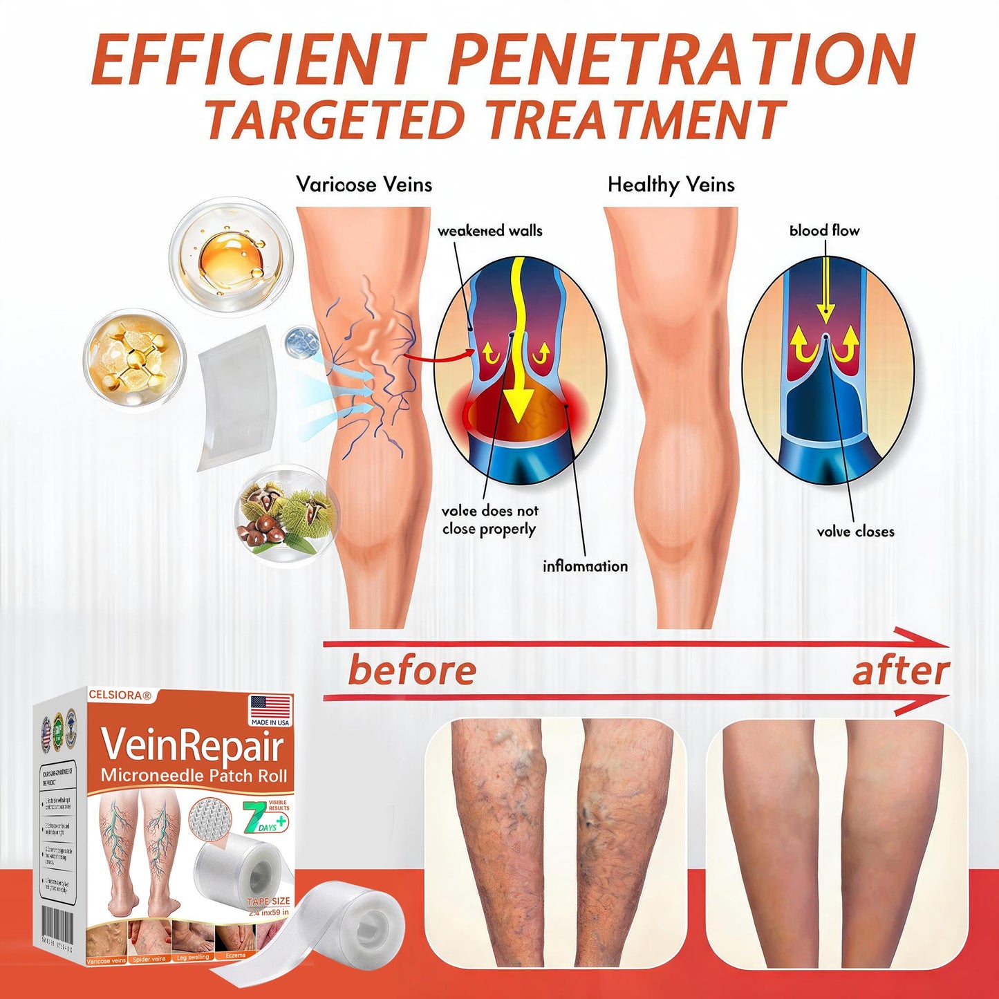👩‍⚕️👩‍⚕️ Final Hours! Save 75% on Celsiora® Vein Ease Microneedle Care Patch(For Spider Veins, Varicose Veins, Swelling & Leg Fatigue) - Last Day Promotion 50% OFF (Copy)