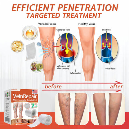 👩‍⚕️👩‍⚕️ Final Hours! Save 75% on Celsiora® Vein Ease Microneedle Care Patch(For Spider Veins, Varicose Veins, Swelling & Leg Fatigue) - Last Day Promotion 50% OFF (Copy)