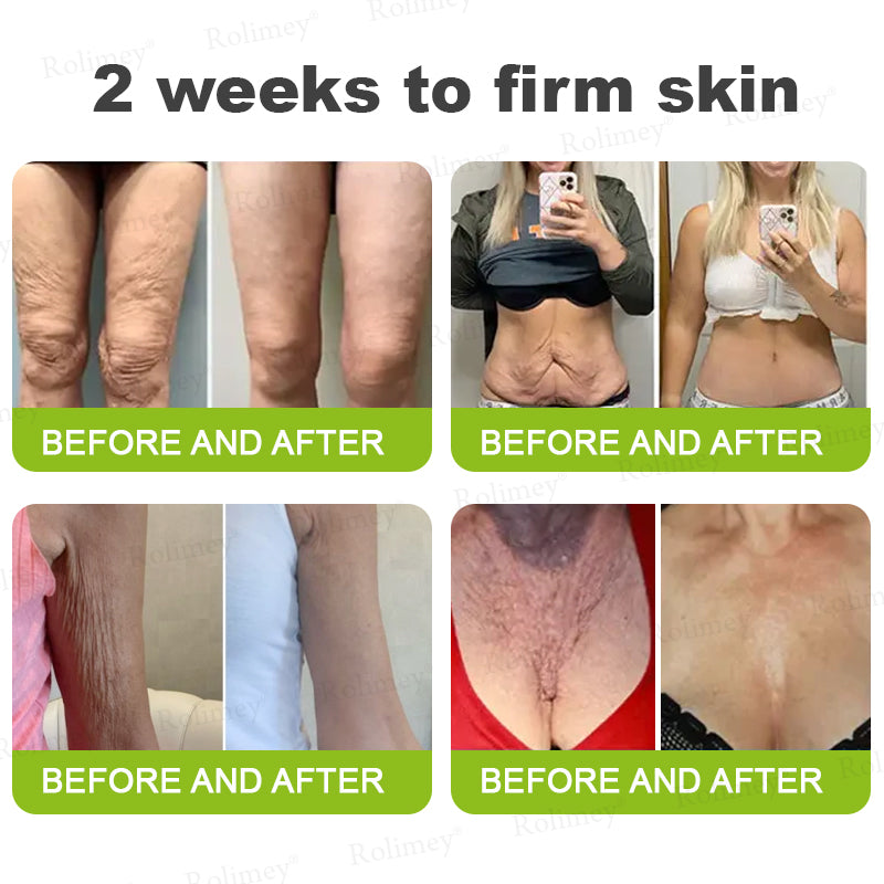 👨‍⚕️🧡Made and shipped from the USA 💫Rolimey® Botox & Vita-A Retinol Shot Wrinkle-Lift Tightening cream - Last Day Promotion 70% OFF