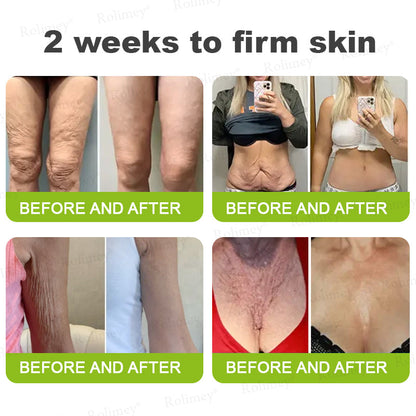 👨‍⚕️🧡Made and shipped from the USA 💫Rolimey® Botox & Vita-A Retinol Shot Wrinkle-Lift Tightening cream - Last Day Promotion 70% OFF