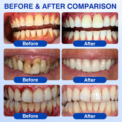 🇺🇸👨‍⚕️✅🦷Evolvion® GumRevive Periodontal Repair Gel