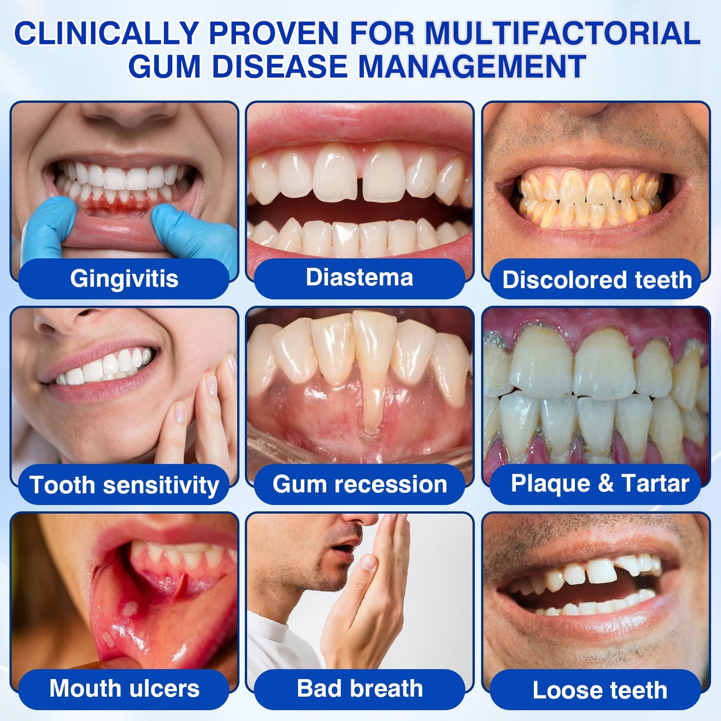 🇺🇸👨‍⚕️✅🦷Evolvion® GumRevive Periodontal Repair Gel