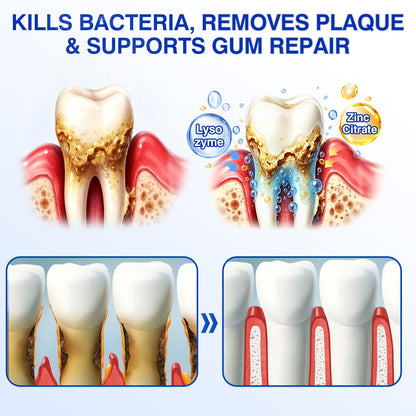 🇺🇸👨‍⚕️✅🦷Evolvion® GumRevive Periodontal Repair Gel
