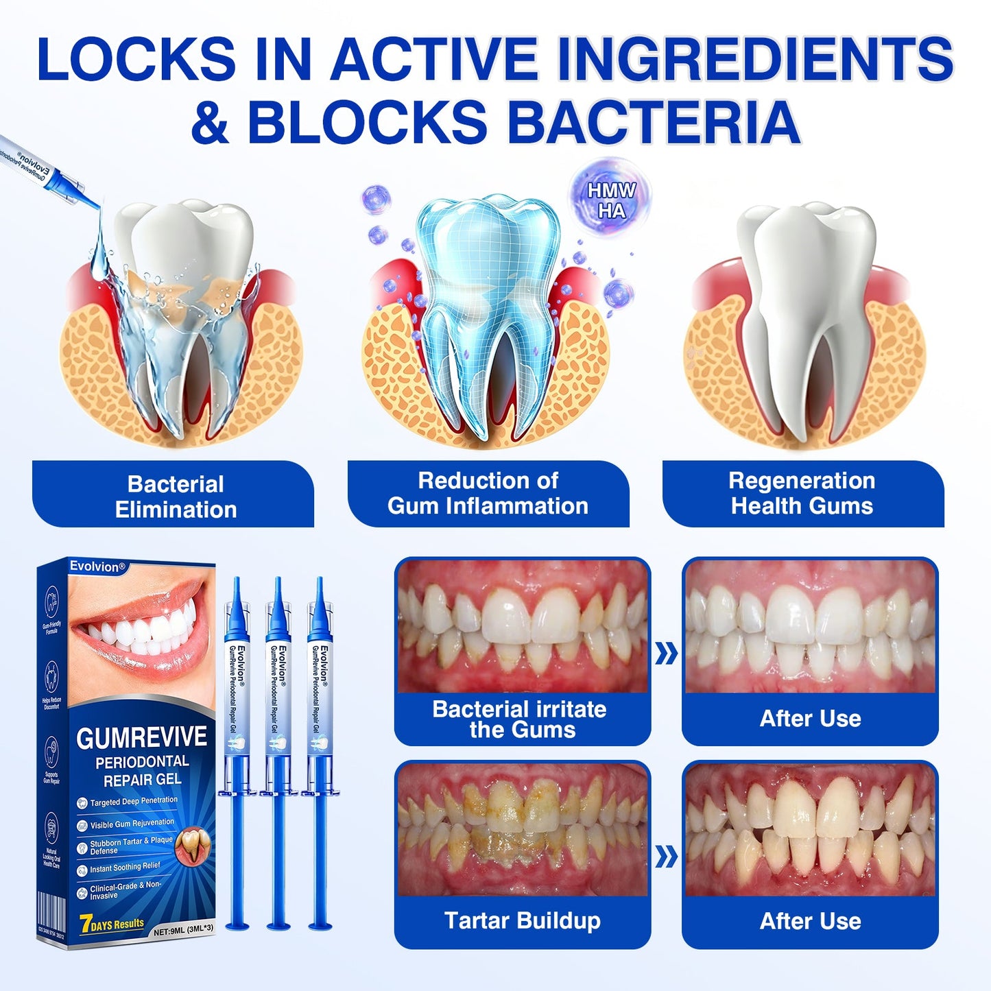 🇺🇸👨‍⚕️✅🦷Evolvion® GumRevive Periodontal Repair Gel