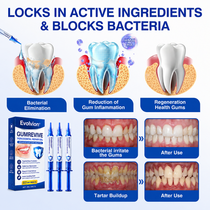 🇺🇸🦷Evolvion® GumRevive Periodontal Repair Gel (For Bleeding Gums, Gum Recession & Loose Teeth)