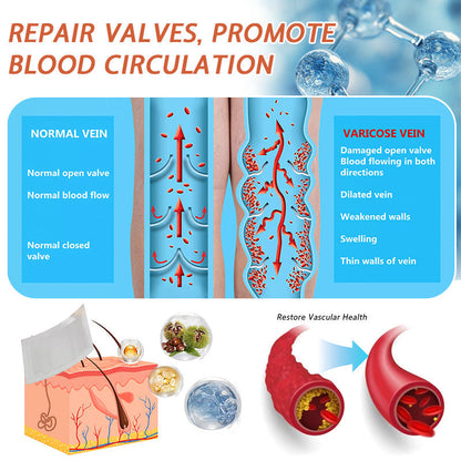 👩‍⚕️👩‍⚕️ Final Hours! Save 75% on Celsiora® Vein Ease Microneedle Care Patch(For Spider Veins, Varicose Veins, Swelling & Leg Fatigue) - Last Day Promotion 50% OFF (Copy)